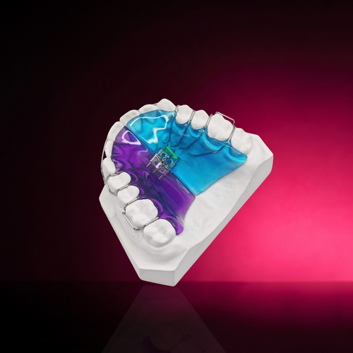 Schwarz palate expander product photo
